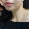 ����